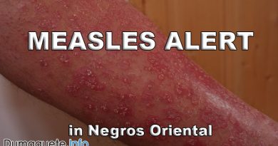Outbreak of Measles in Negros Oriental