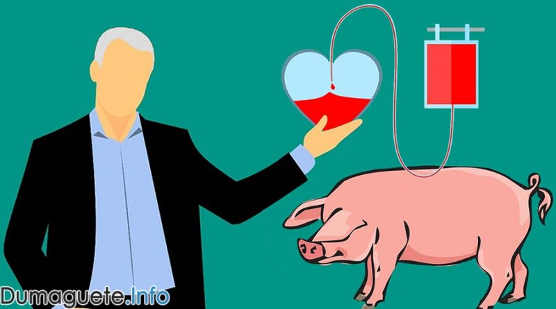 Human with Genetically Altered Pig’s Heart Beating for 4 Days!